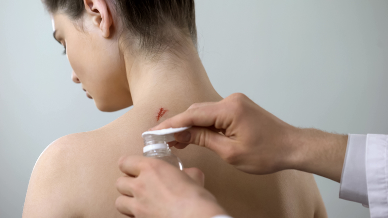 how-to-clean-treat-and-cover-minor-wounds-first-aid-supplies-online