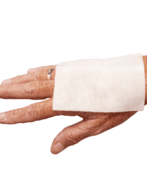 Burn Free burn dressing applied to hand.