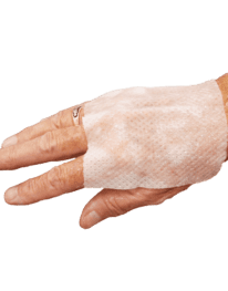 Burn Stop Hydrogel Burn Dressing applied to hand